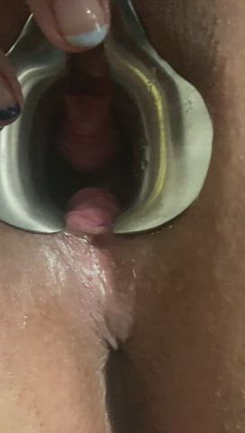 Anal Speculum Breeding Creampie sperm Freeuse threesome Gaping Stretching Porn GIF